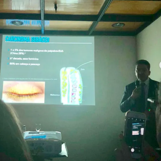 Dr. Rafael Gontijo apresentando aula sobre carcinoma sebáceo